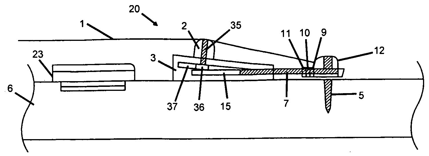 Bridge system for improved acoustic coupling in stringed instruments