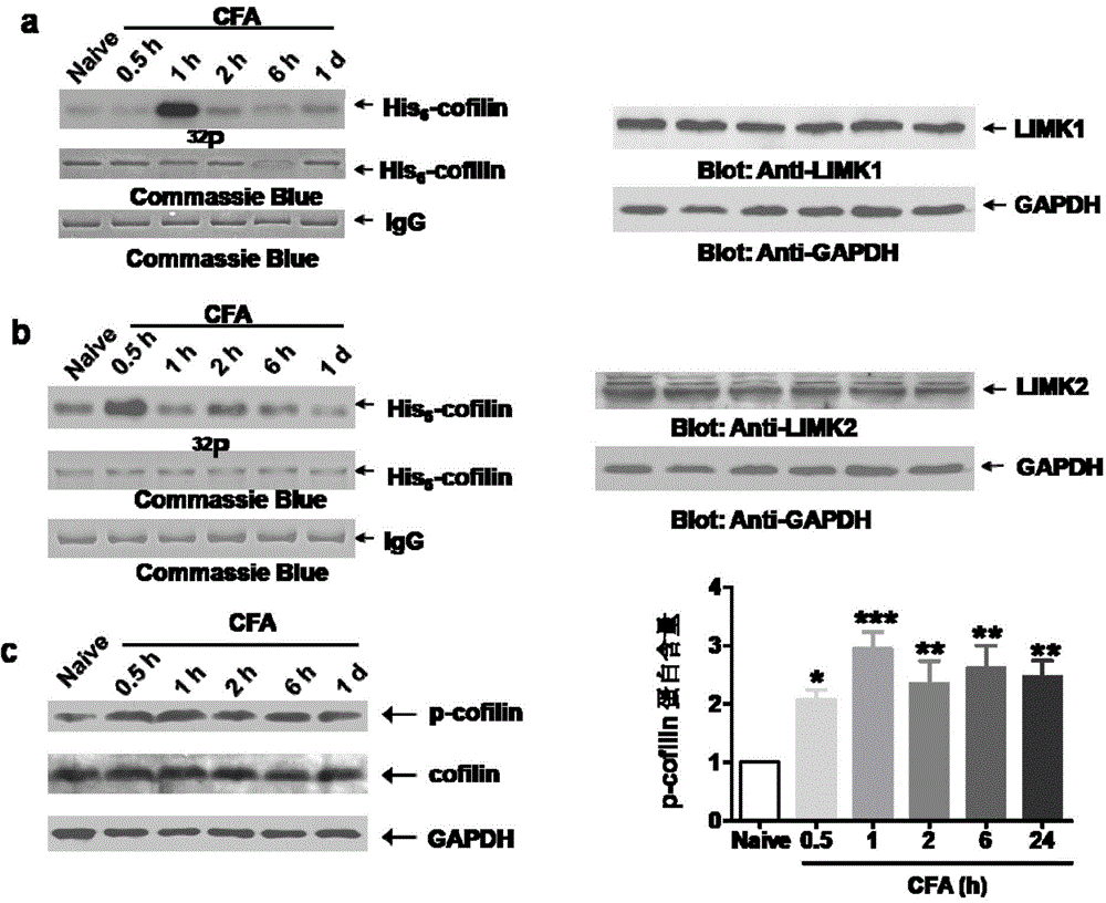 Transmembrane polypeptide with analgesic effect