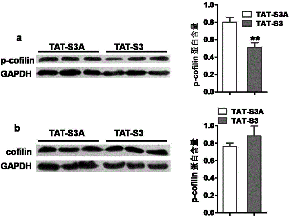 Transmembrane polypeptide with analgesic effect