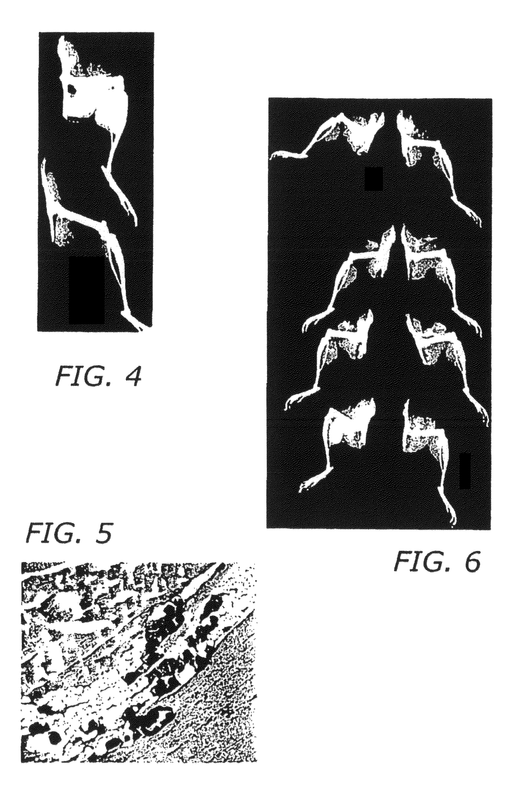 Surgical applications for BMP binding protein