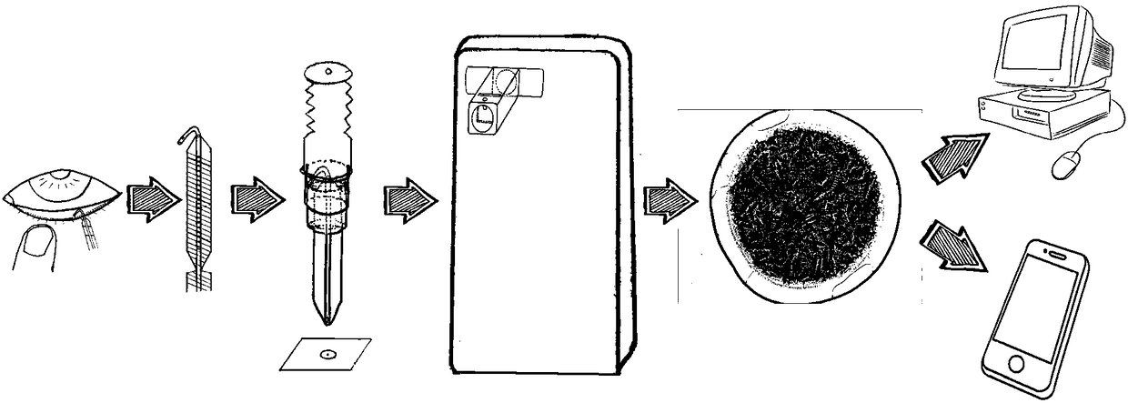 Tear remote acquisition and analysis device and method for diagnosing dry eyes