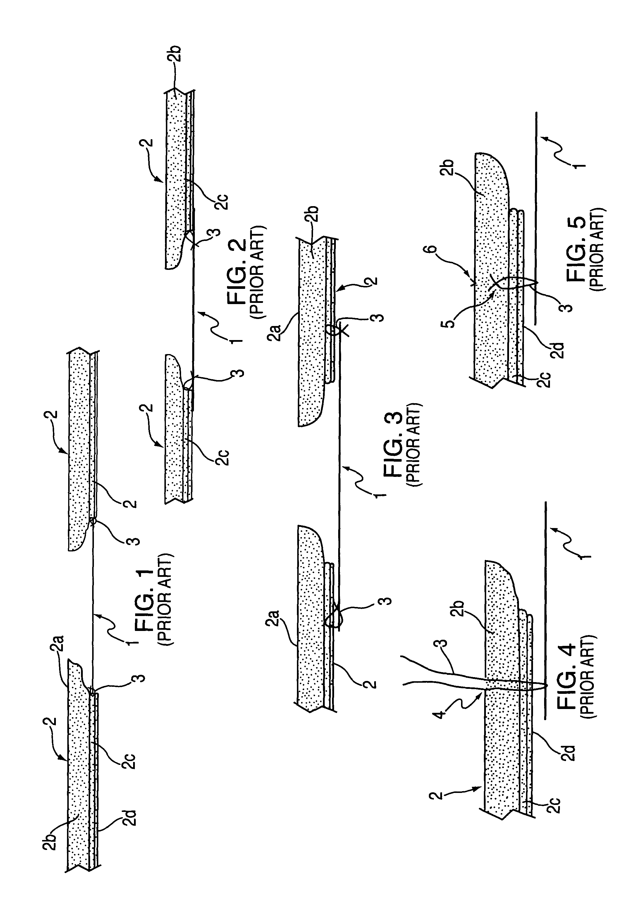 Device and method for tacking a prosthetic screen