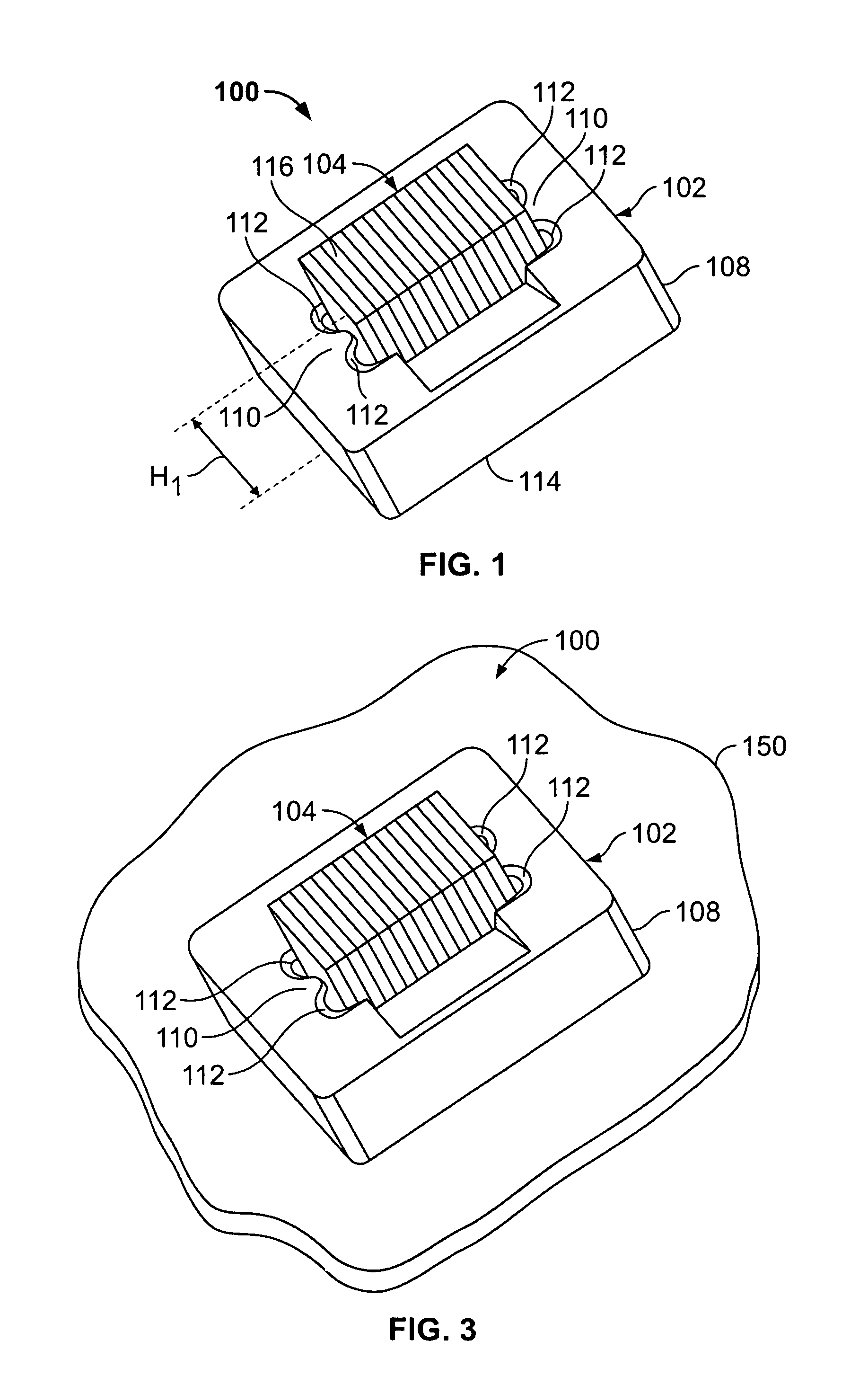Bonded elastomeric connector