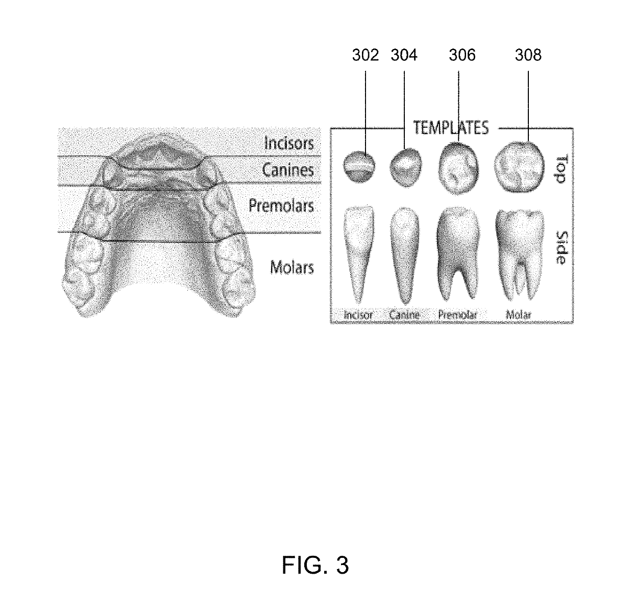 Model-based teeth reconstruction