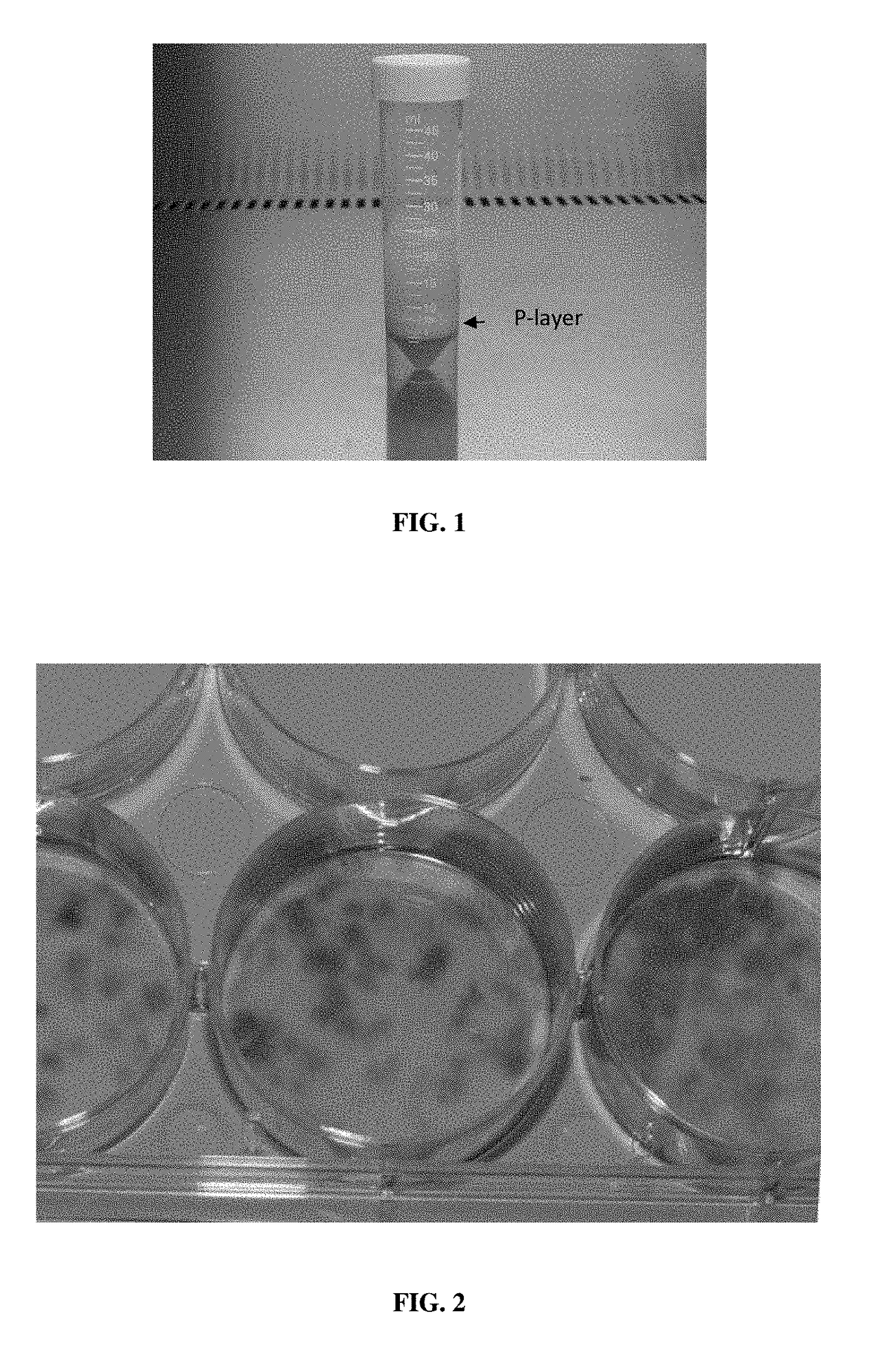 Isolation of stem cells from adipose tissue by ultrasonic cavitation, and methods of use