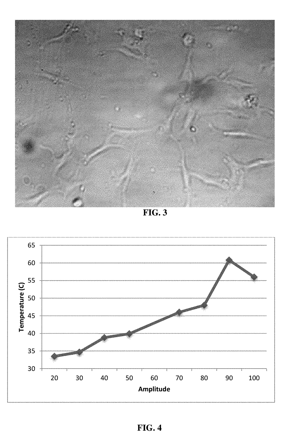 Isolation of stem cells from adipose tissue by ultrasonic cavitation, and methods of use