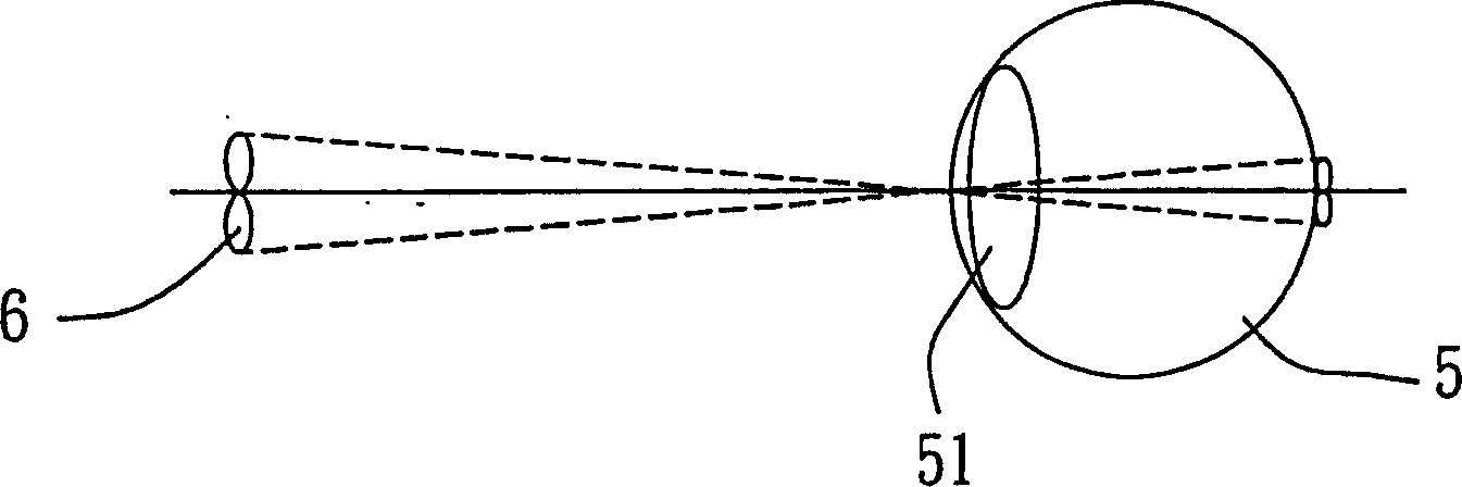 Refractive image display device