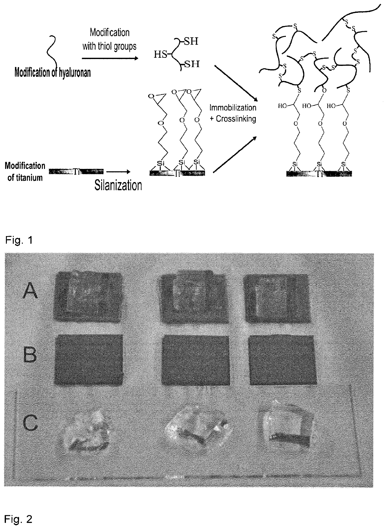 Intraocular device and method for preparing the same