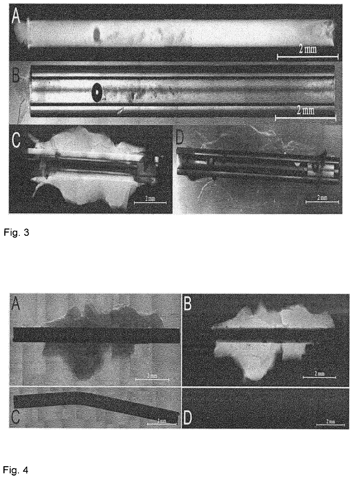 Intraocular device and method for preparing the same