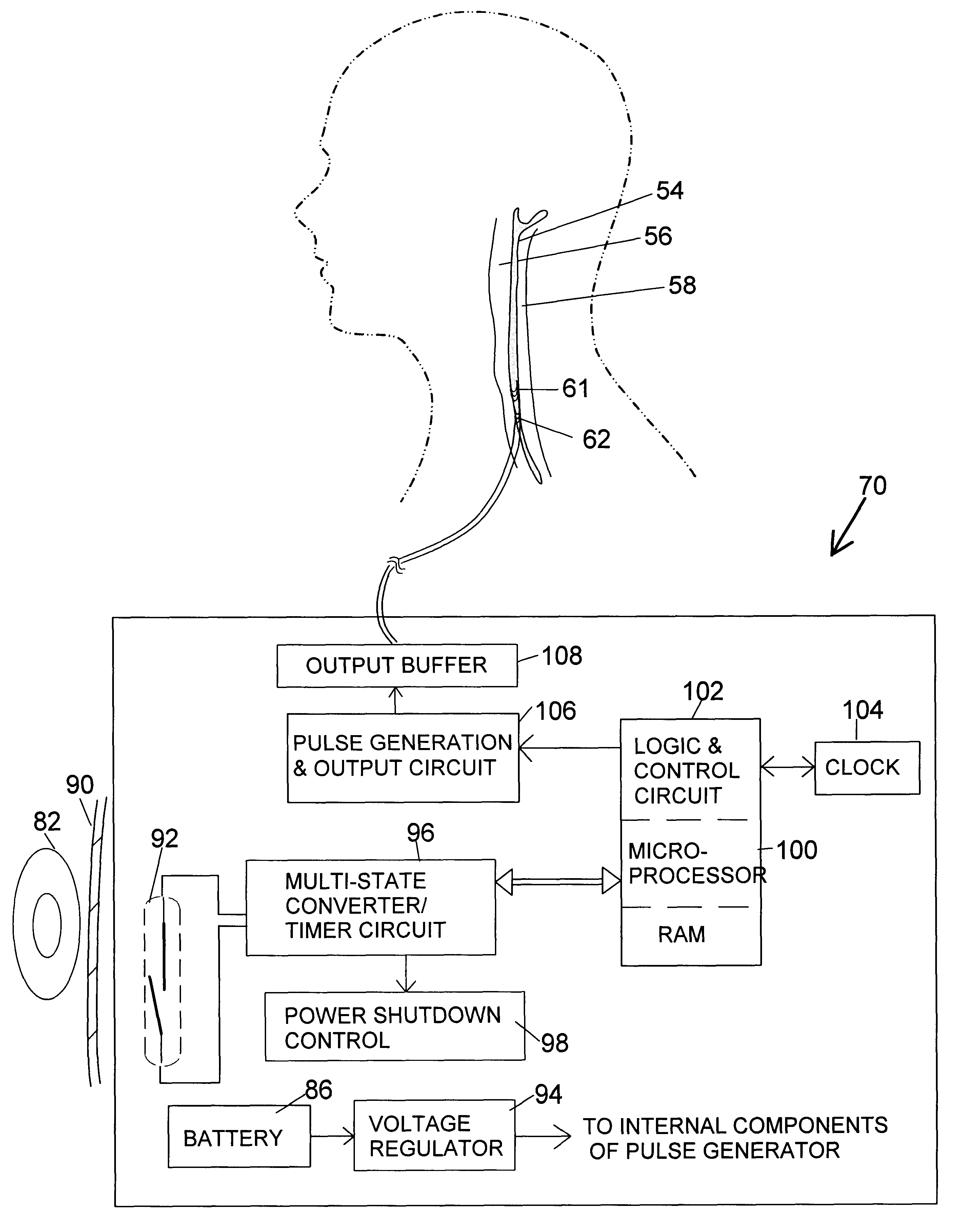 Apparatus and method for treatment of neurological and neuropsychiatric disorders using programmerless implantable pulse generator system