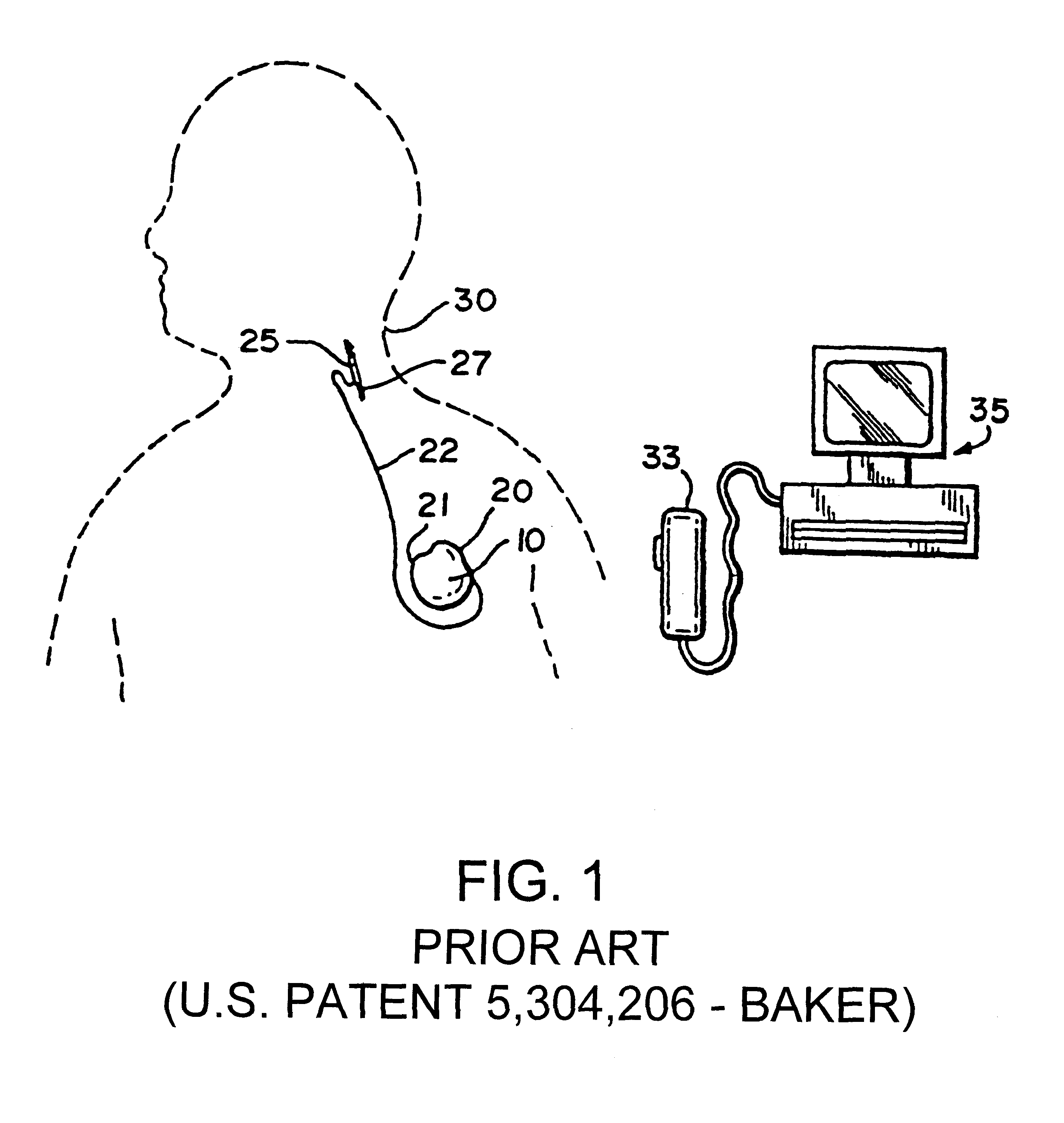Apparatus and method for treatment of neurological and neuropsychiatric disorders using programmerless implantable pulse generator system
