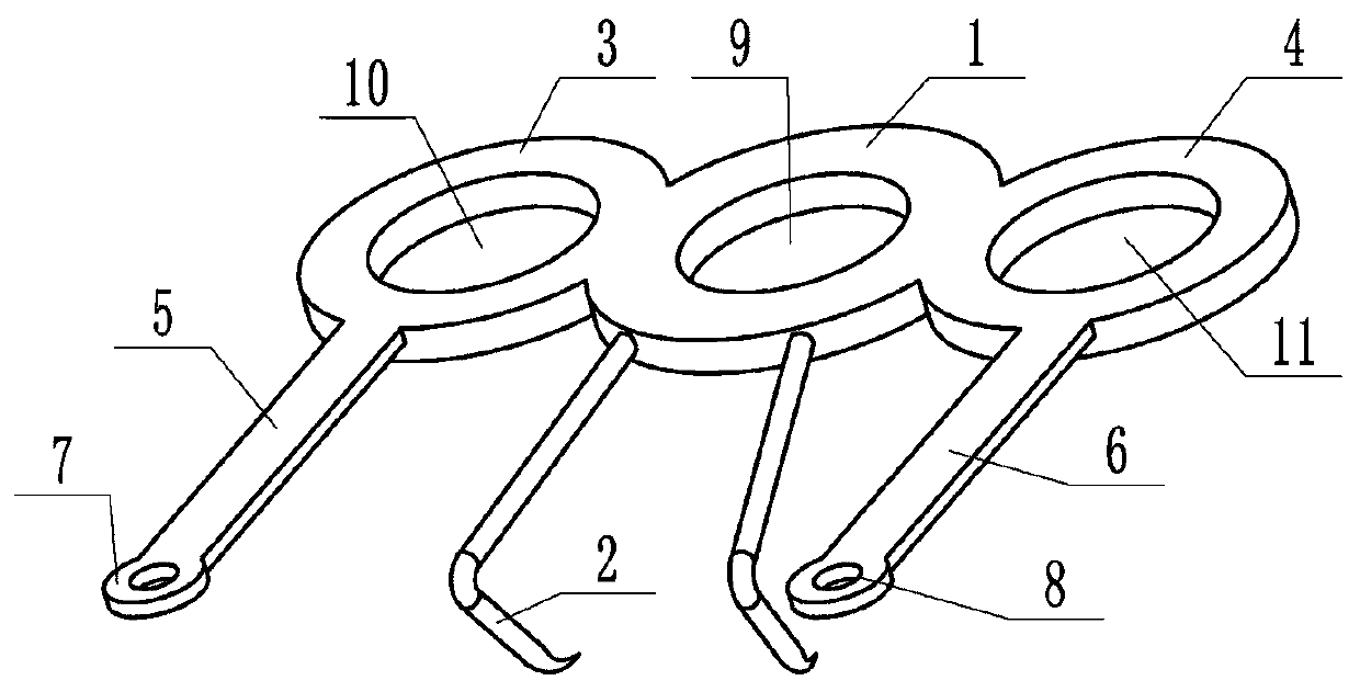 anchor fracture fixation device