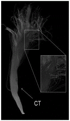 A spatial rendering method and system for brain nerve fibers