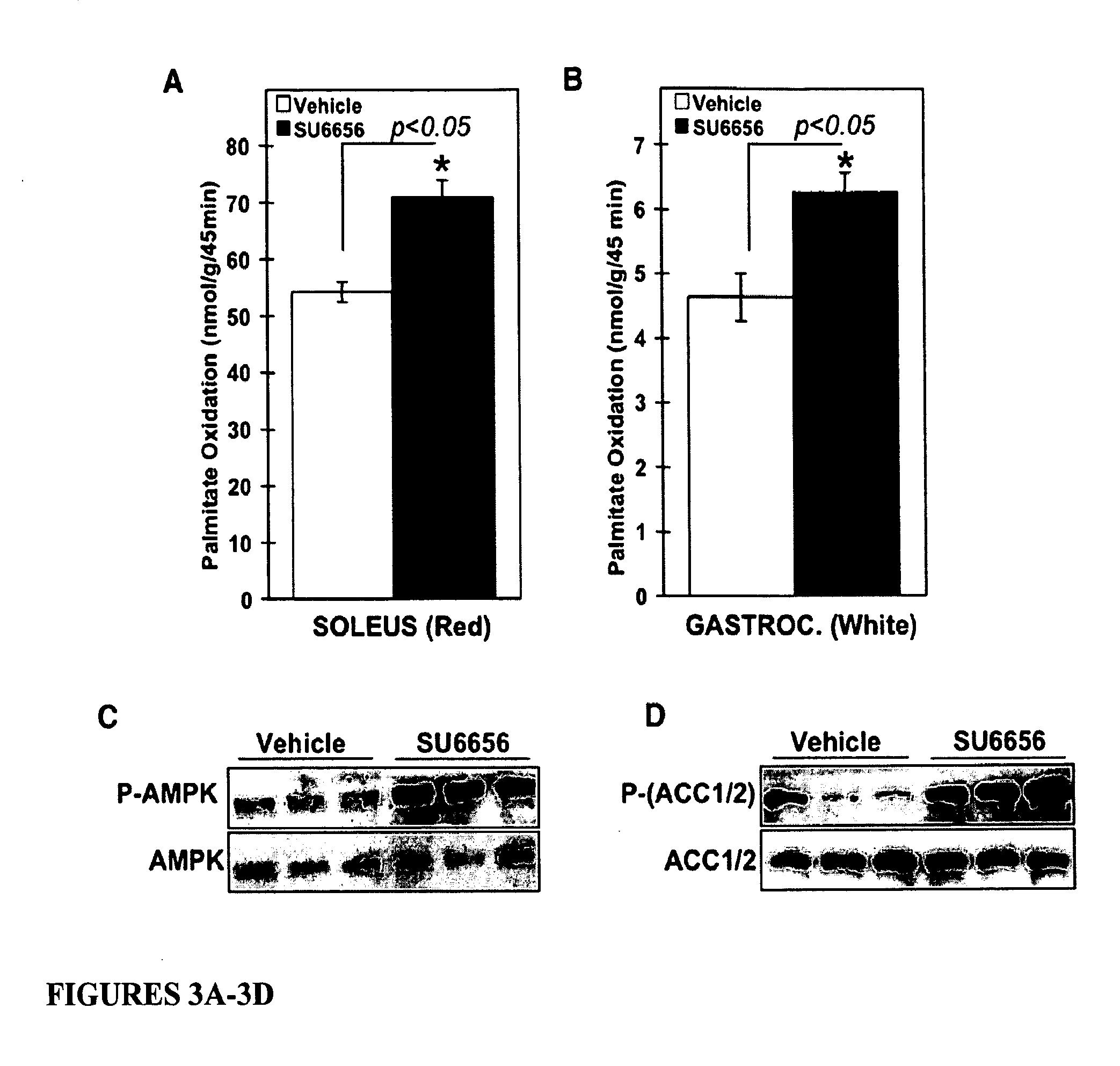 Methods of suppressing cancer, increasing weight loss and/or increasing insulin sensitivity