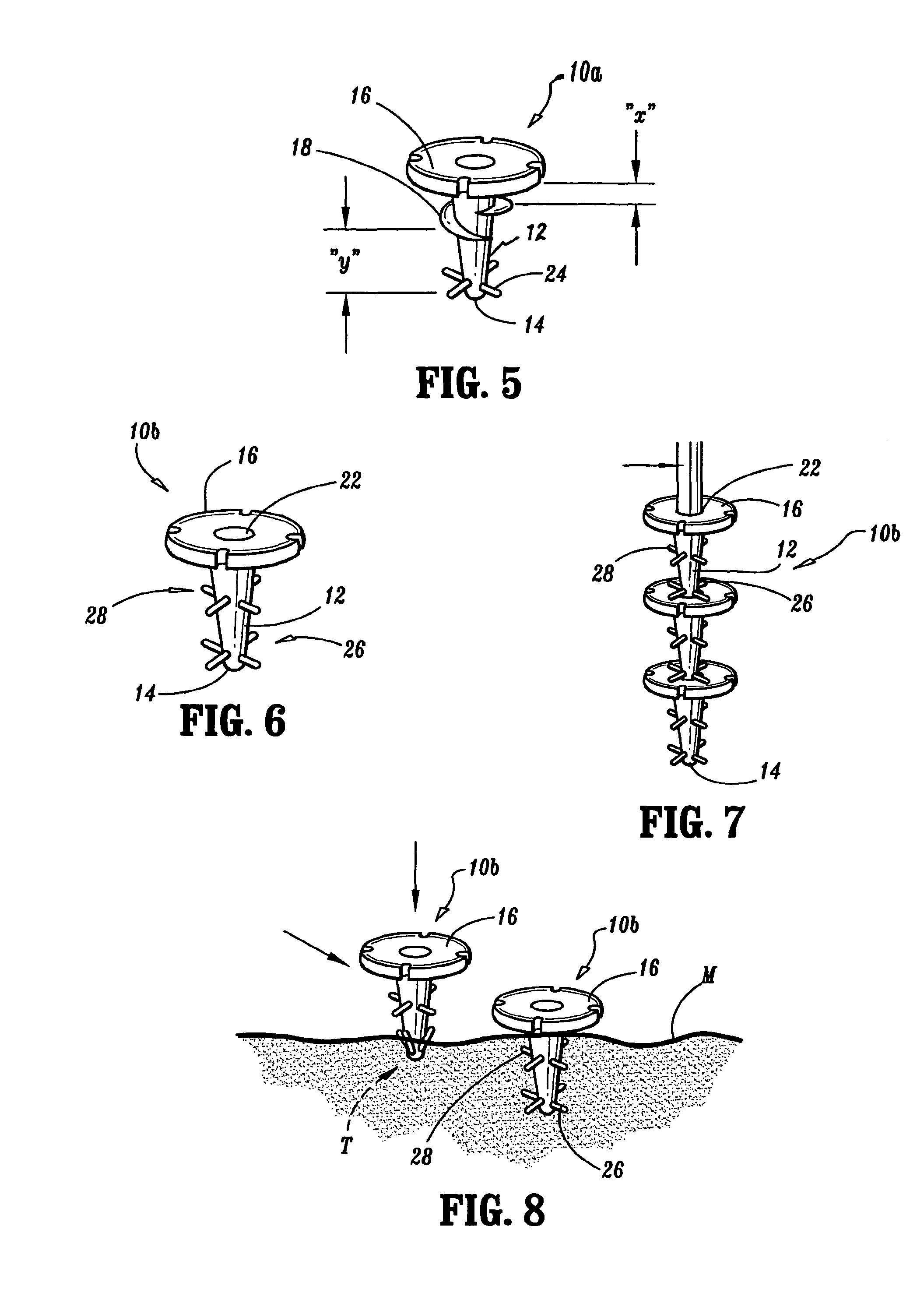 Surgical fasteners