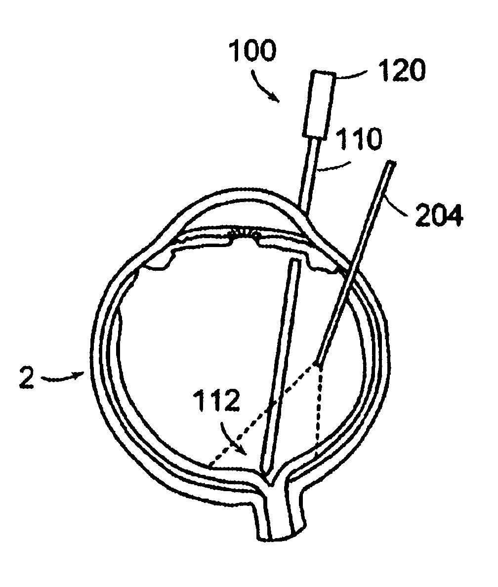 Laminar cribosa puncture device, methods related to use of such a device and methods for treating central retinal vein occulsions
