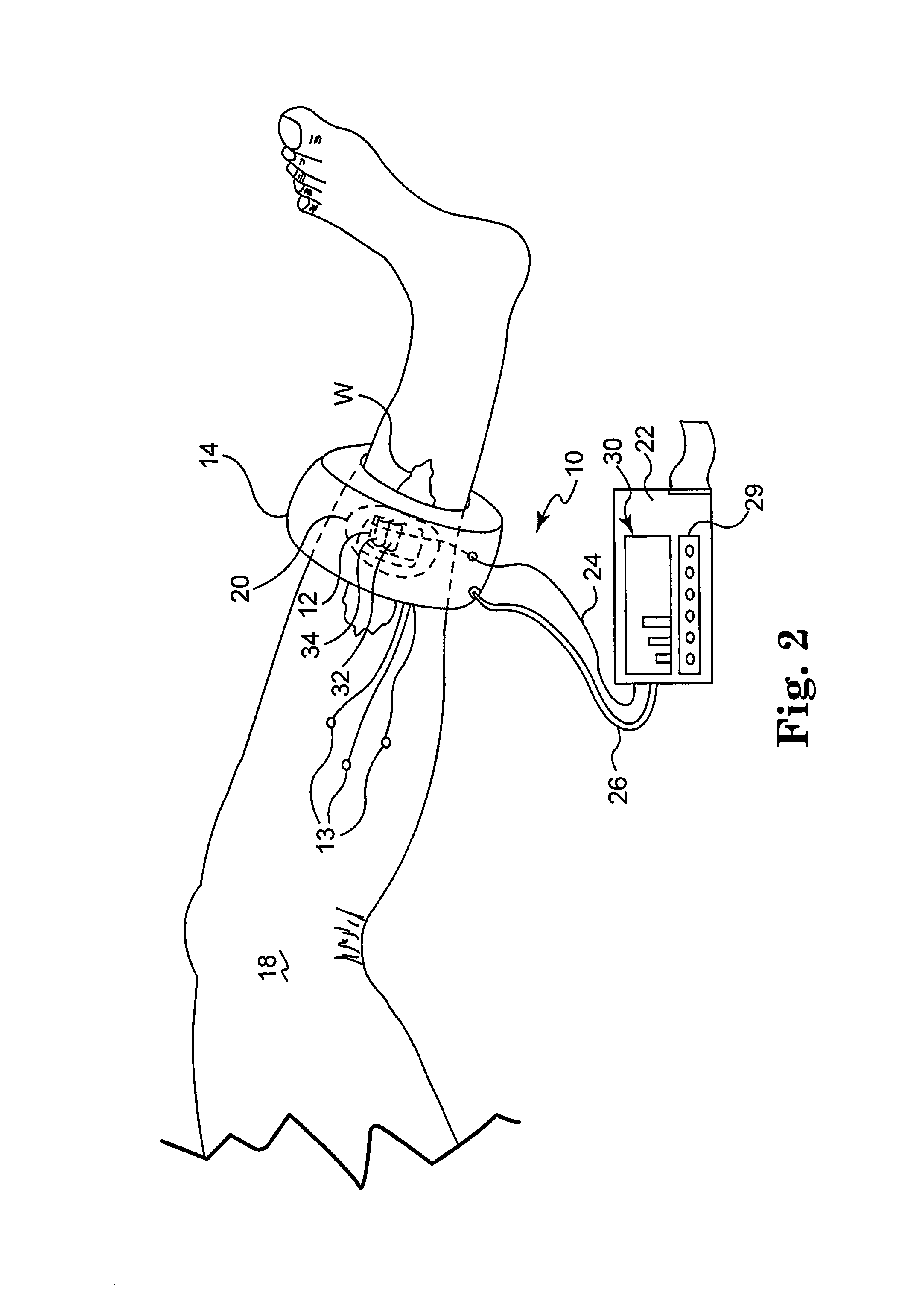 System and method for assessing capillary vitality