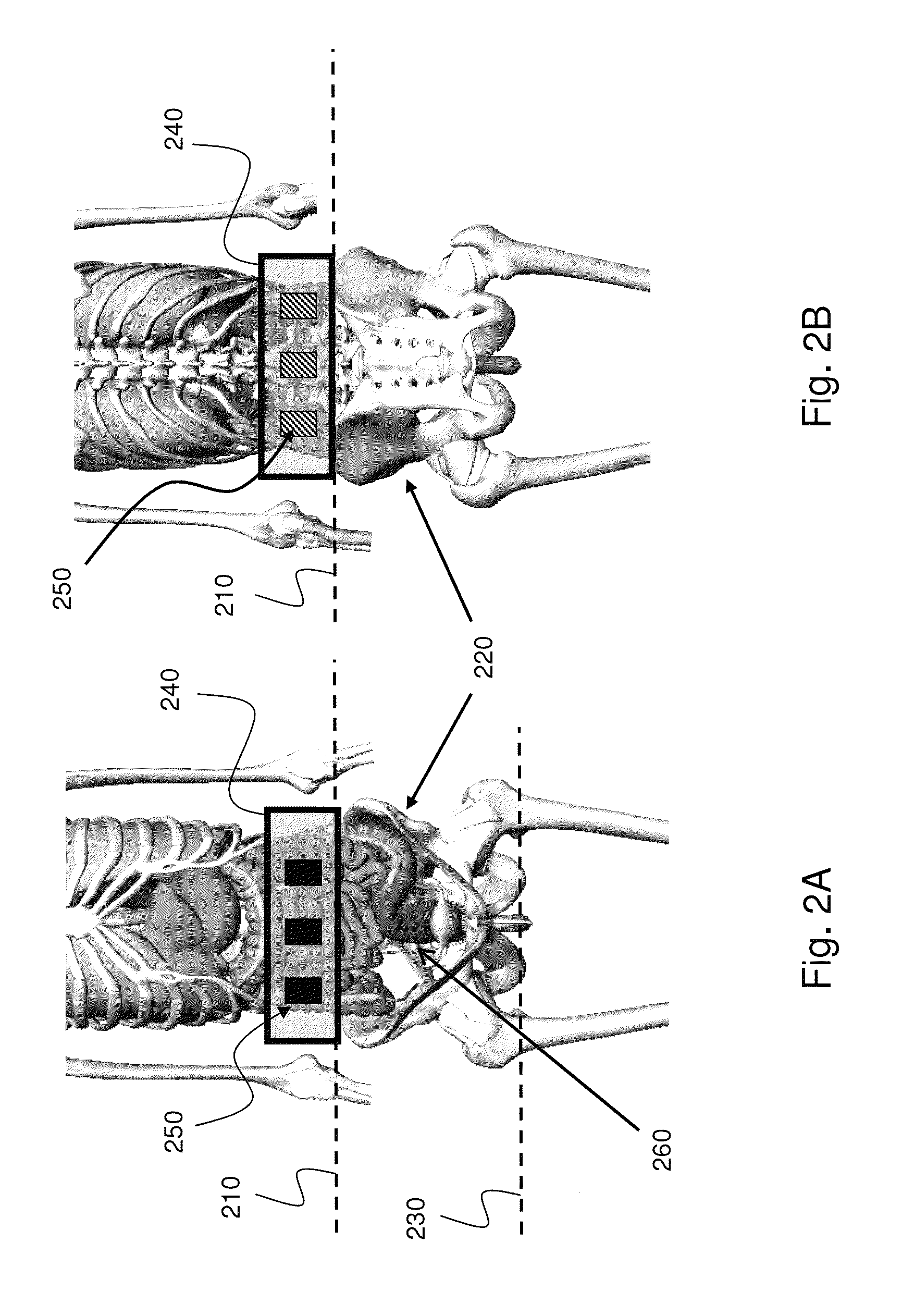 Wearable antenna assembly for an in-vivo device
