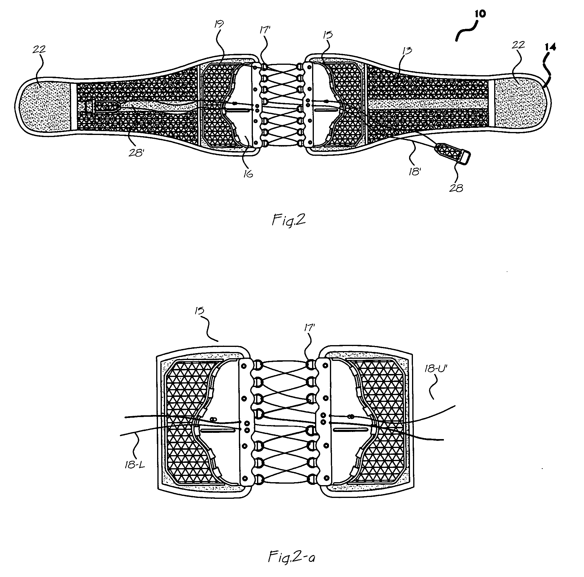 String arrangement of a separate back immobilizing, dynamically self-adjusting, customizing back support for a vertebra related patient