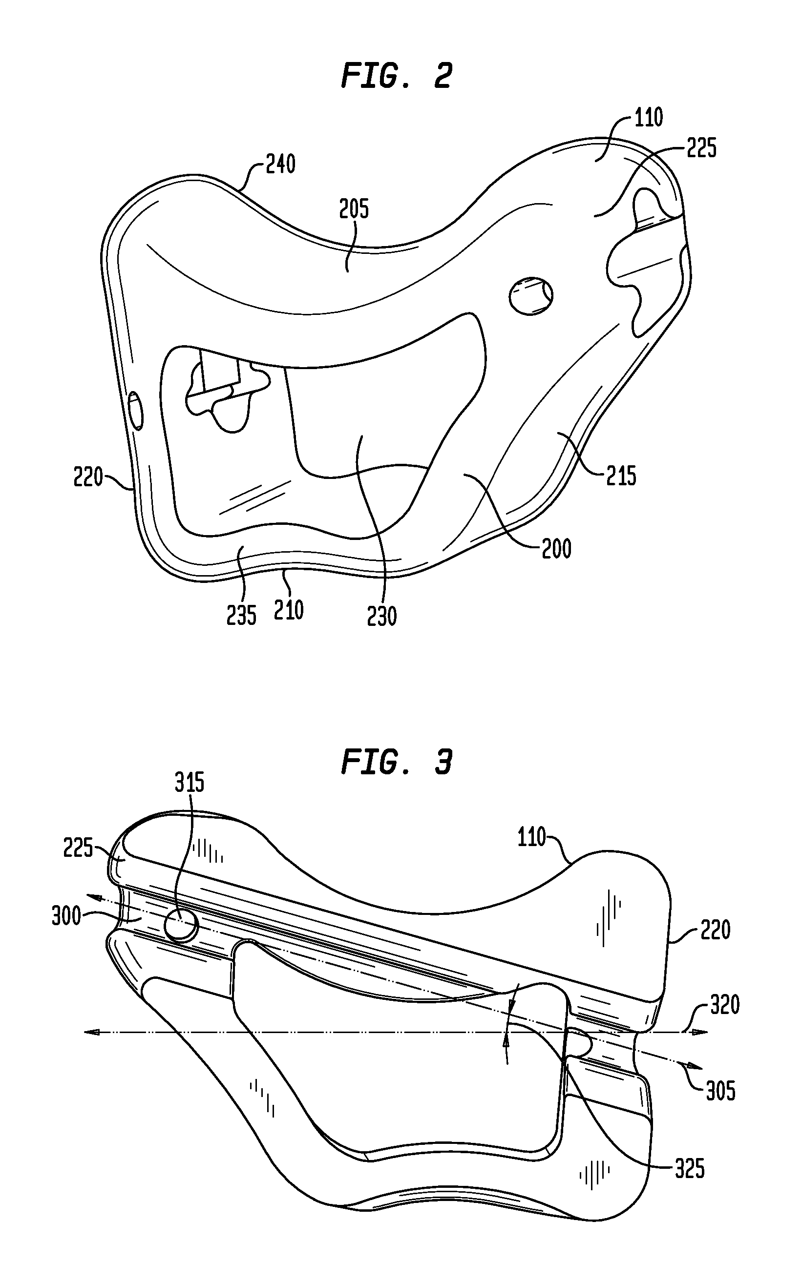 System and method for trapezium bone replacement