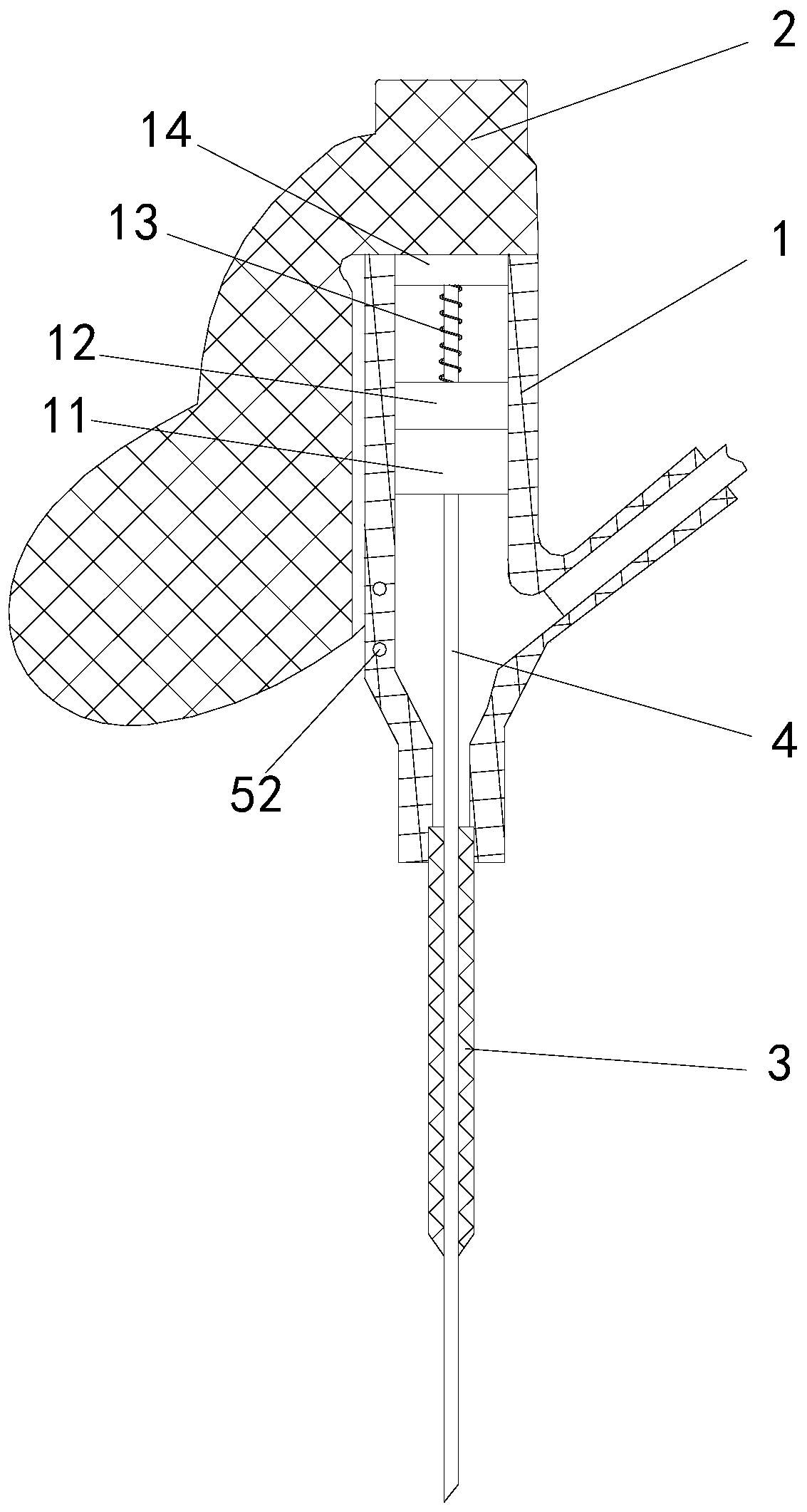 Novel remaining needle with function of automatically conveying catheter by single hand