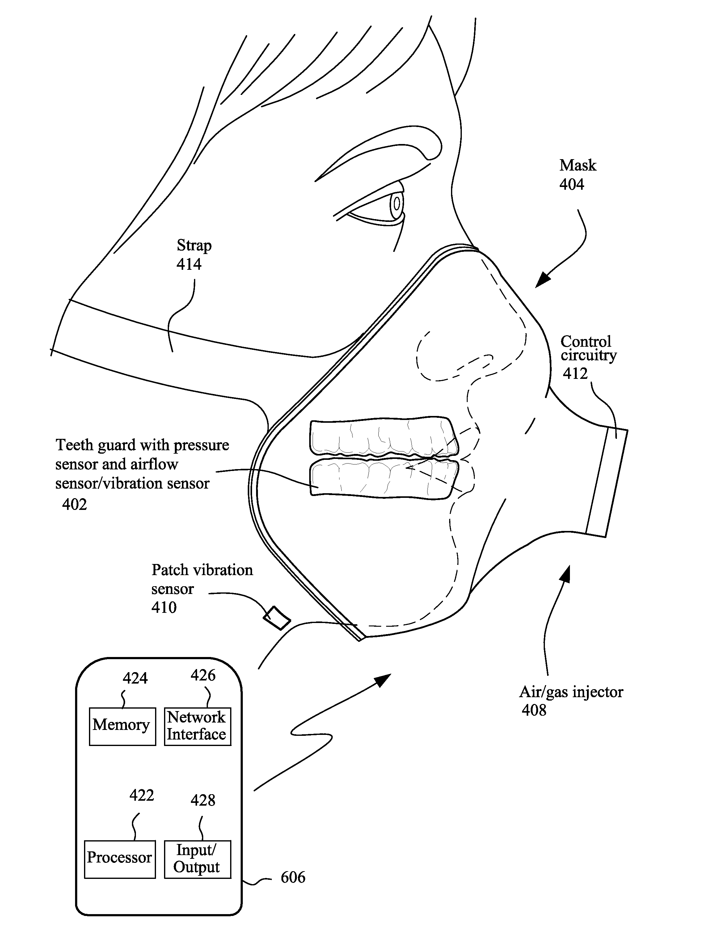 Methods and devices for monitoring bruxism and/or sleep apnea and alleviating associated conditions