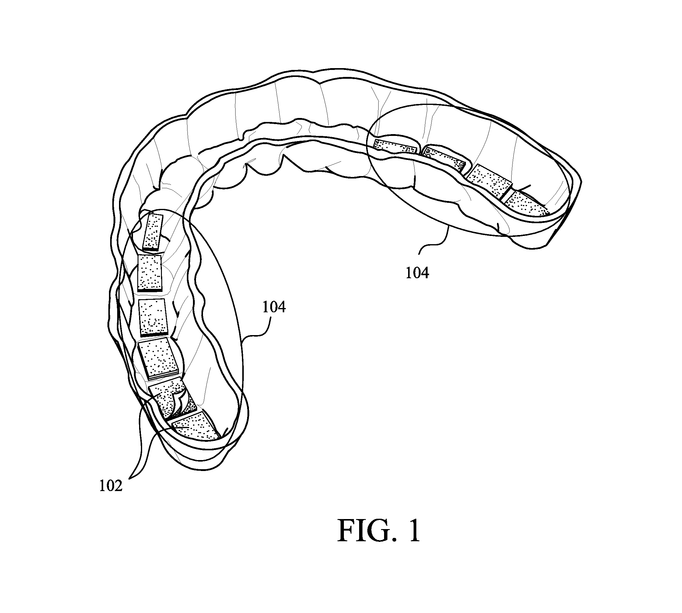 Methods and devices for monitoring bruxism and/or sleep apnea and alleviating associated conditions