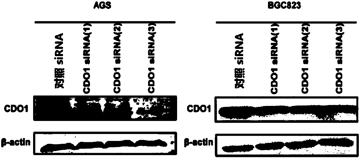 Application of CDO1 in preparing stomach cancer treating drug associated with ferroptosis