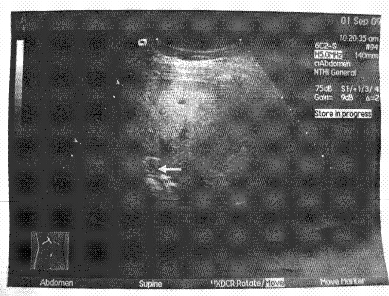 New application of normal saline injection in preparation of diagnosticum