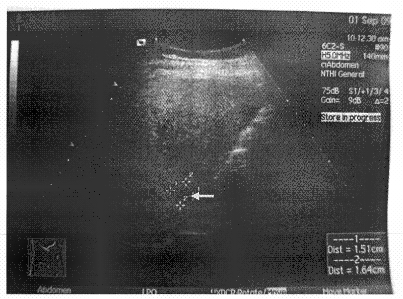 New application of normal saline injection in preparation of diagnosticum