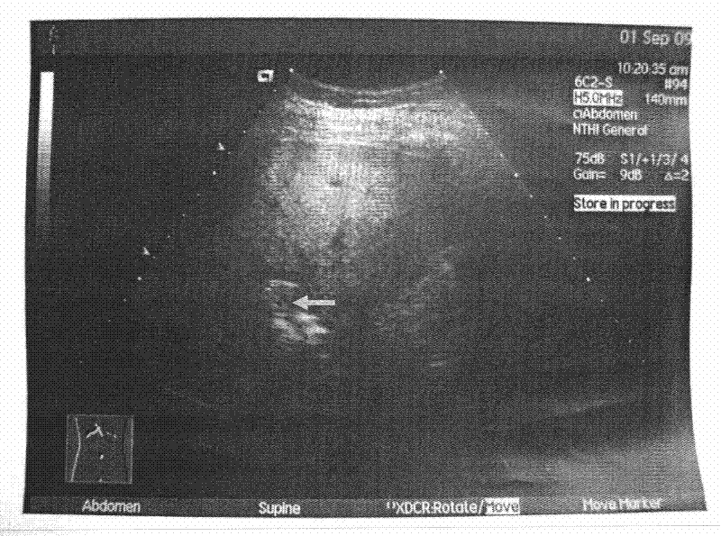 New application of normal saline injection in preparation of diagnosticum