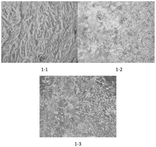 Novel dermal matrix decellularization method