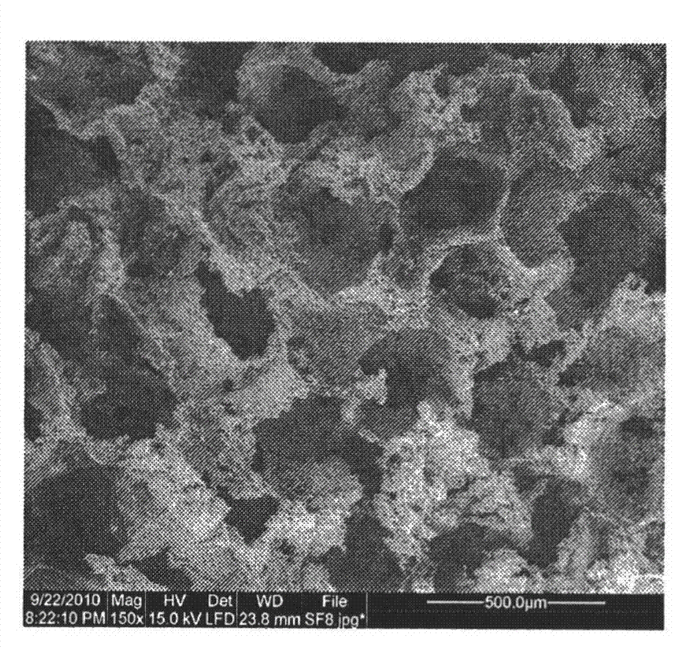 Preparation method of silk fibroin/hydroxyapatite/collagen composite porous stent