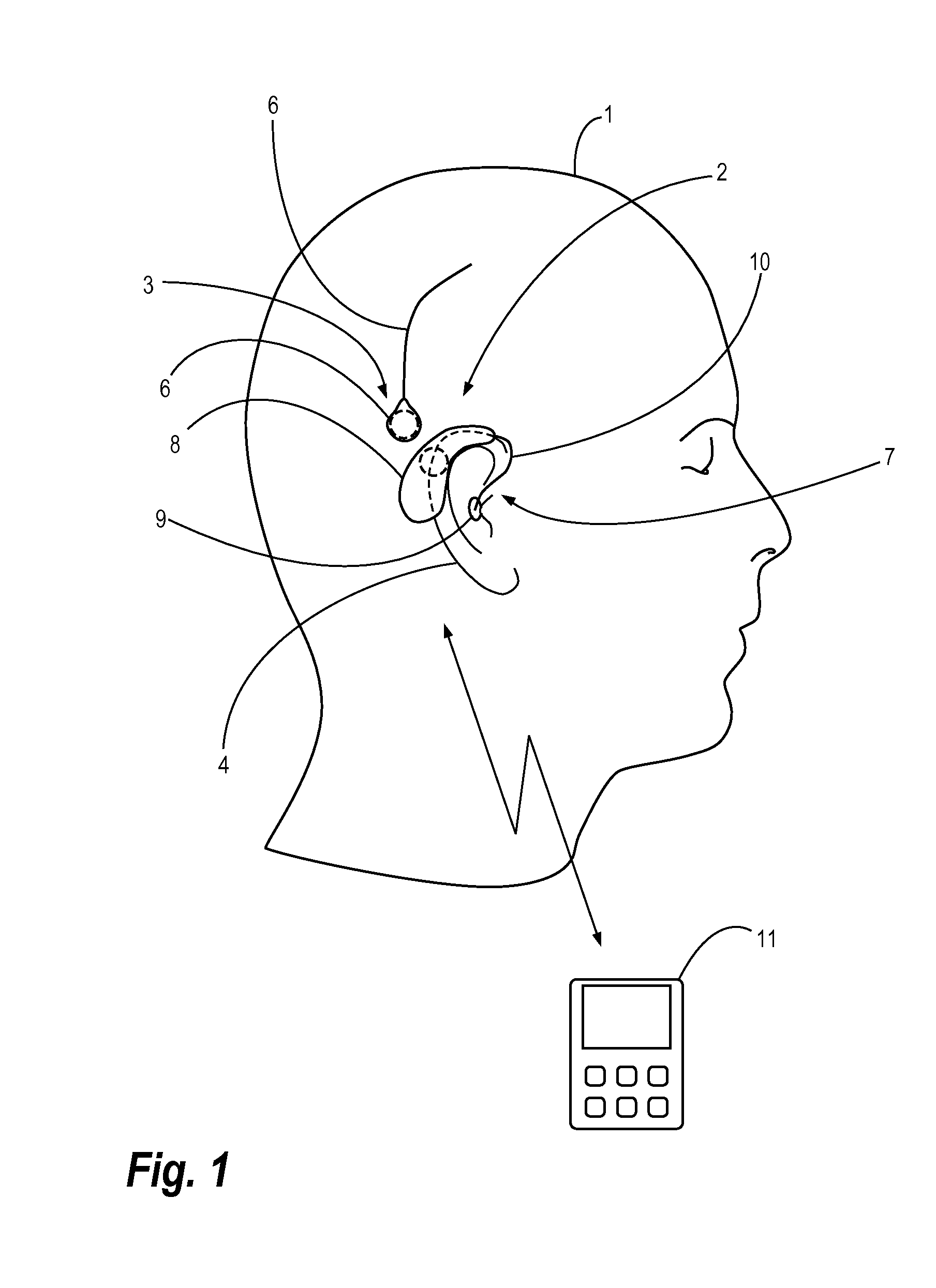 Eeg monitoring apparatus and method for presenting messages therein