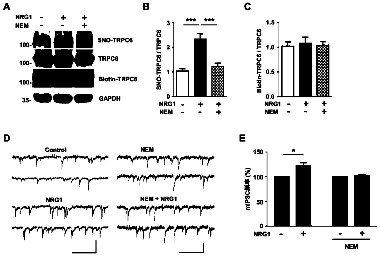 Application of Neuregulin-1 (NRG1) in preparation of product to enhance Transient Receptor Potential Cation Channel Subfamily C Member 6 (TRPC6) channel activity