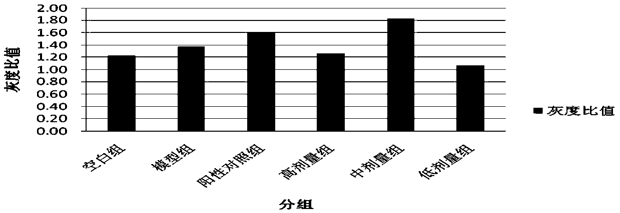 A kind of pharmaceutical composition and its preparation method, preparation and application