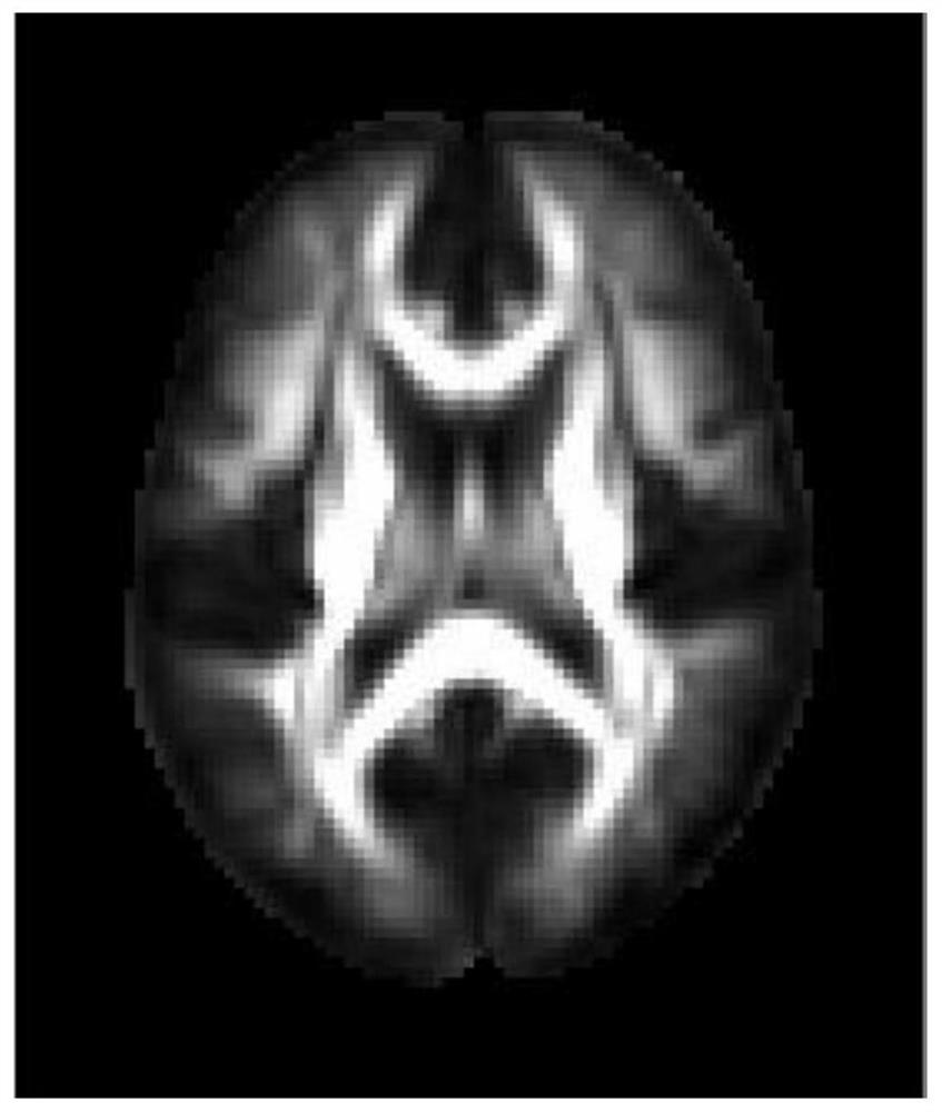 Brain tensor template construction method based on diffusion tensor imaging
