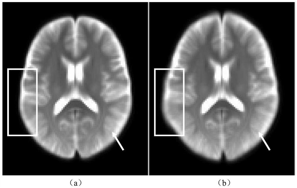 Brain tensor template construction method based on diffusion tensor imaging