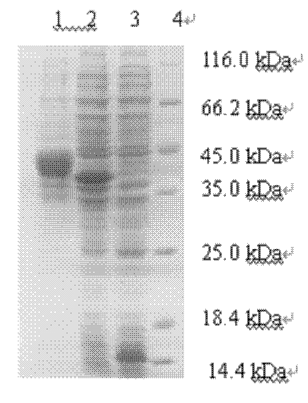 HIV (Human Immunodeficiency Virus) recombinant fusion antigen as well as expression gene and preparation method thereof