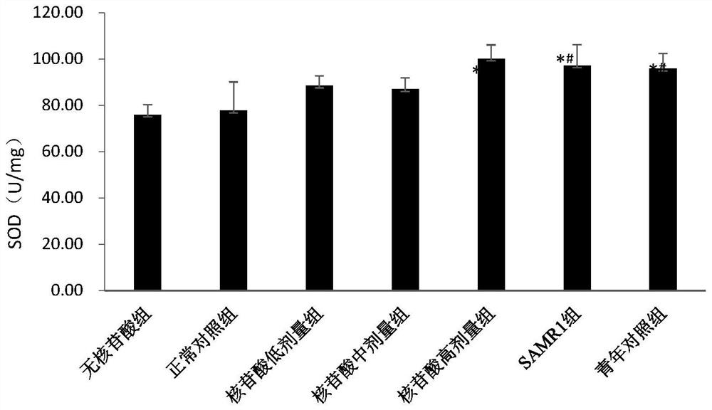 Application of nucleotide mixture in preparation of preparation for preventing or relieving senile sarcopenia