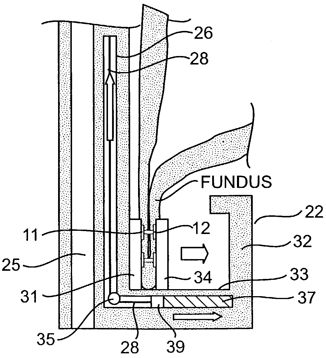 Devices and related methods for securing a tissue fold
