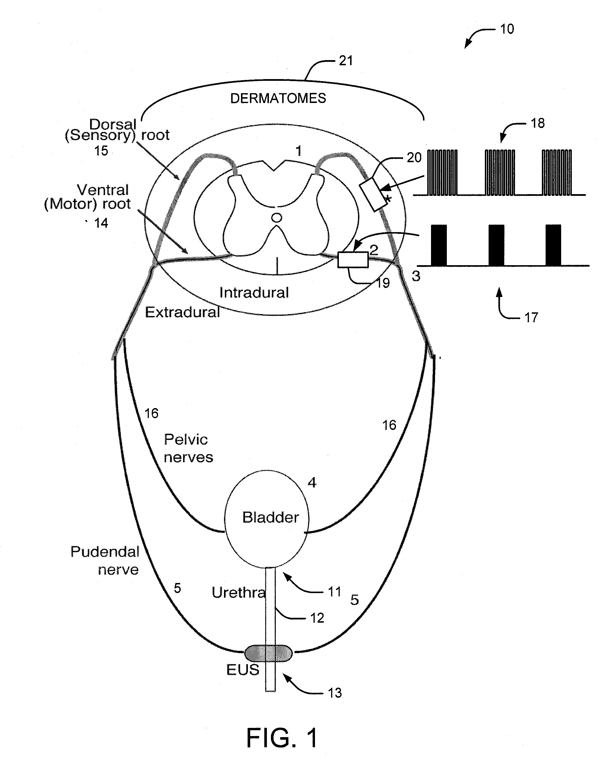 System and Method of Bladder and Sphincter Control