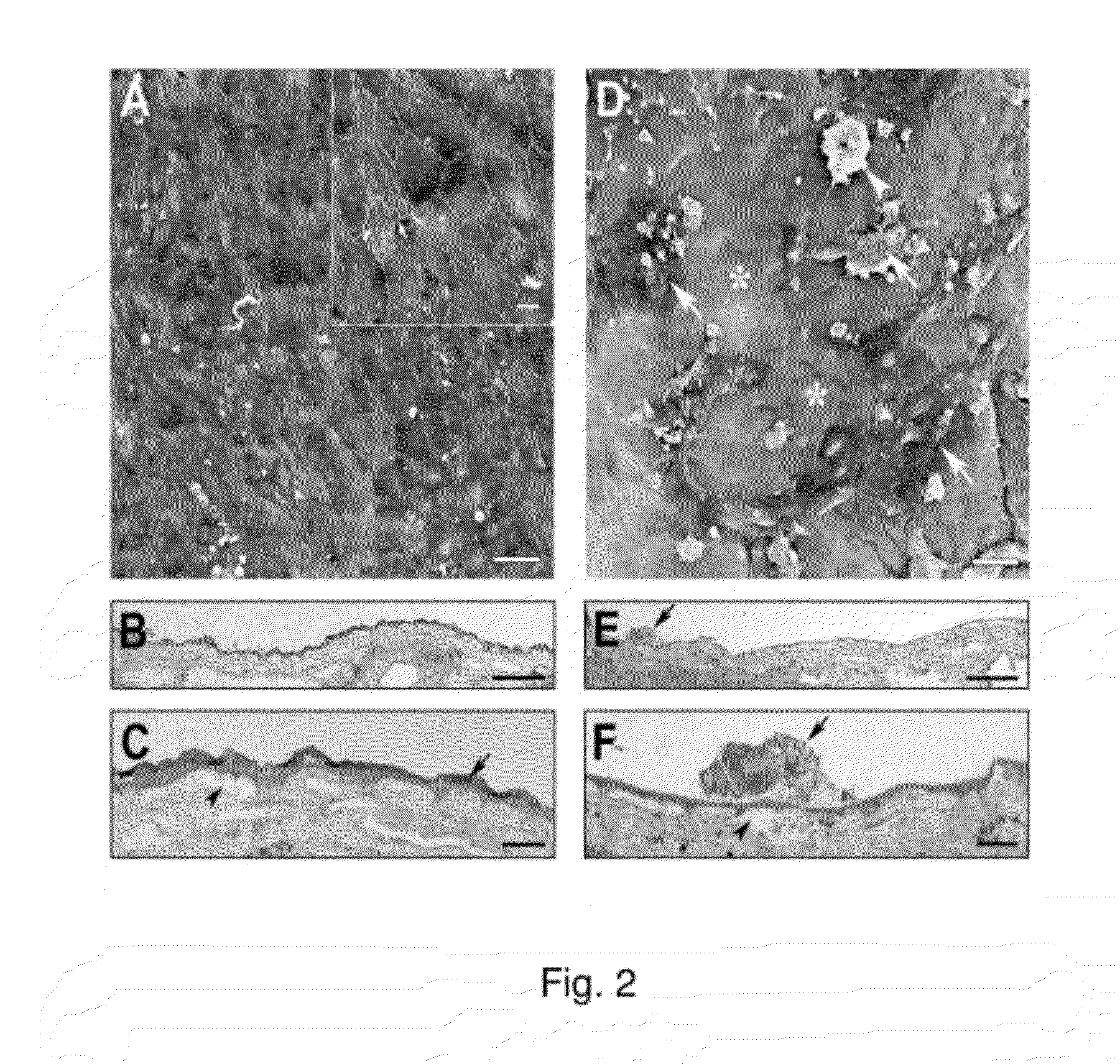 Production of extracellular matrix, conditioned media and uses thereof
