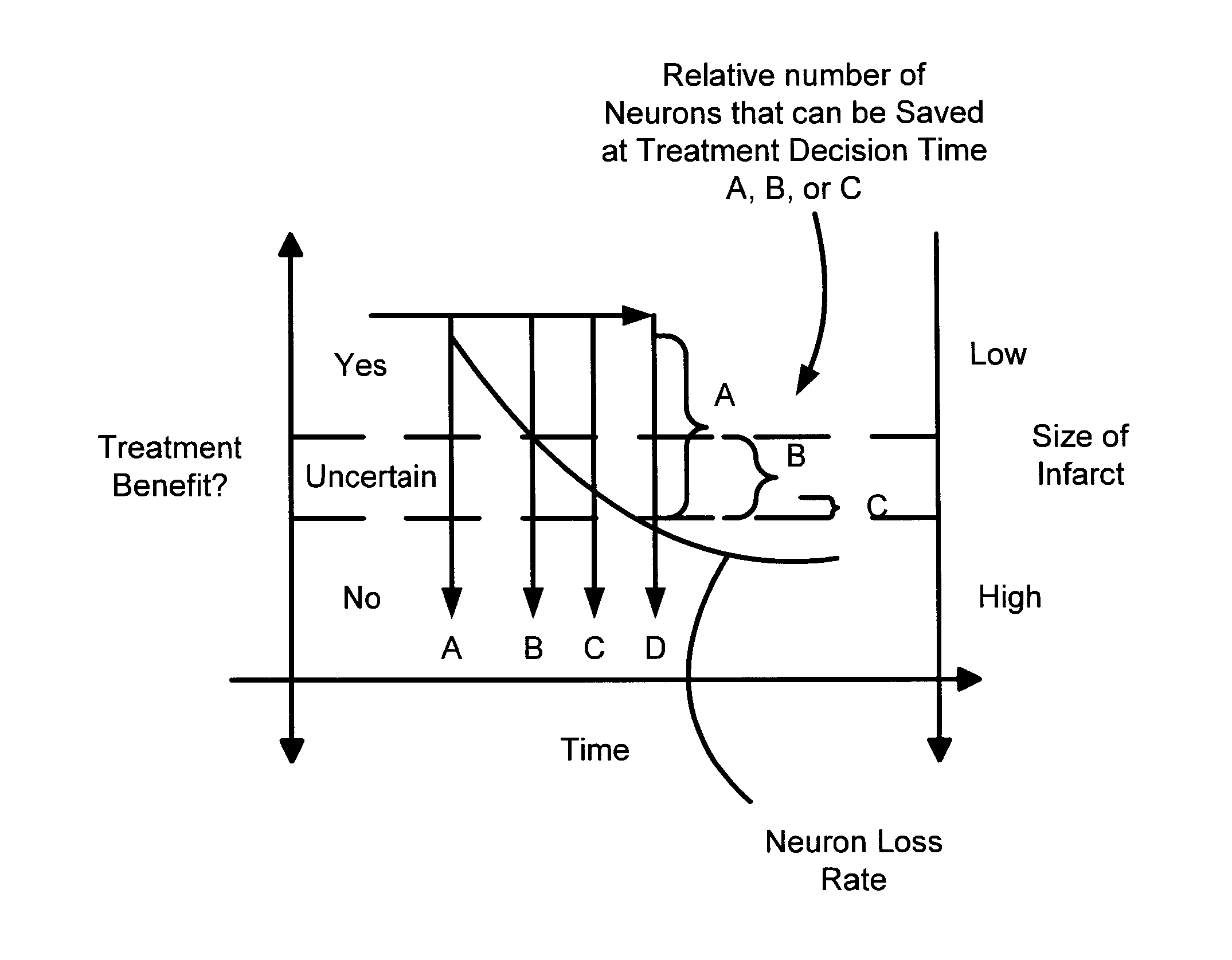 Systems and methods for diagnosing strokes