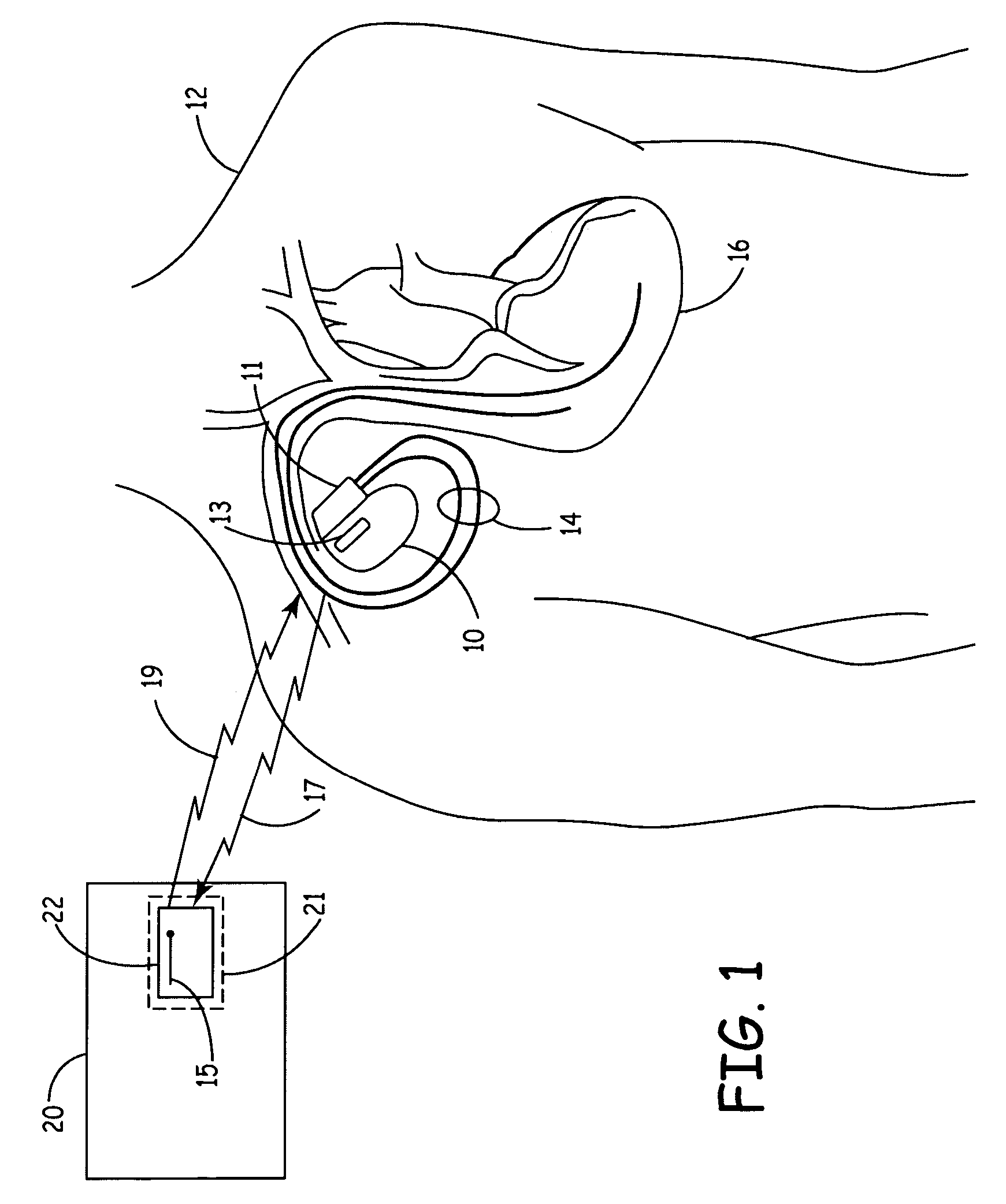 Implantable medical device programmer module for use with existing clinical instrumentation