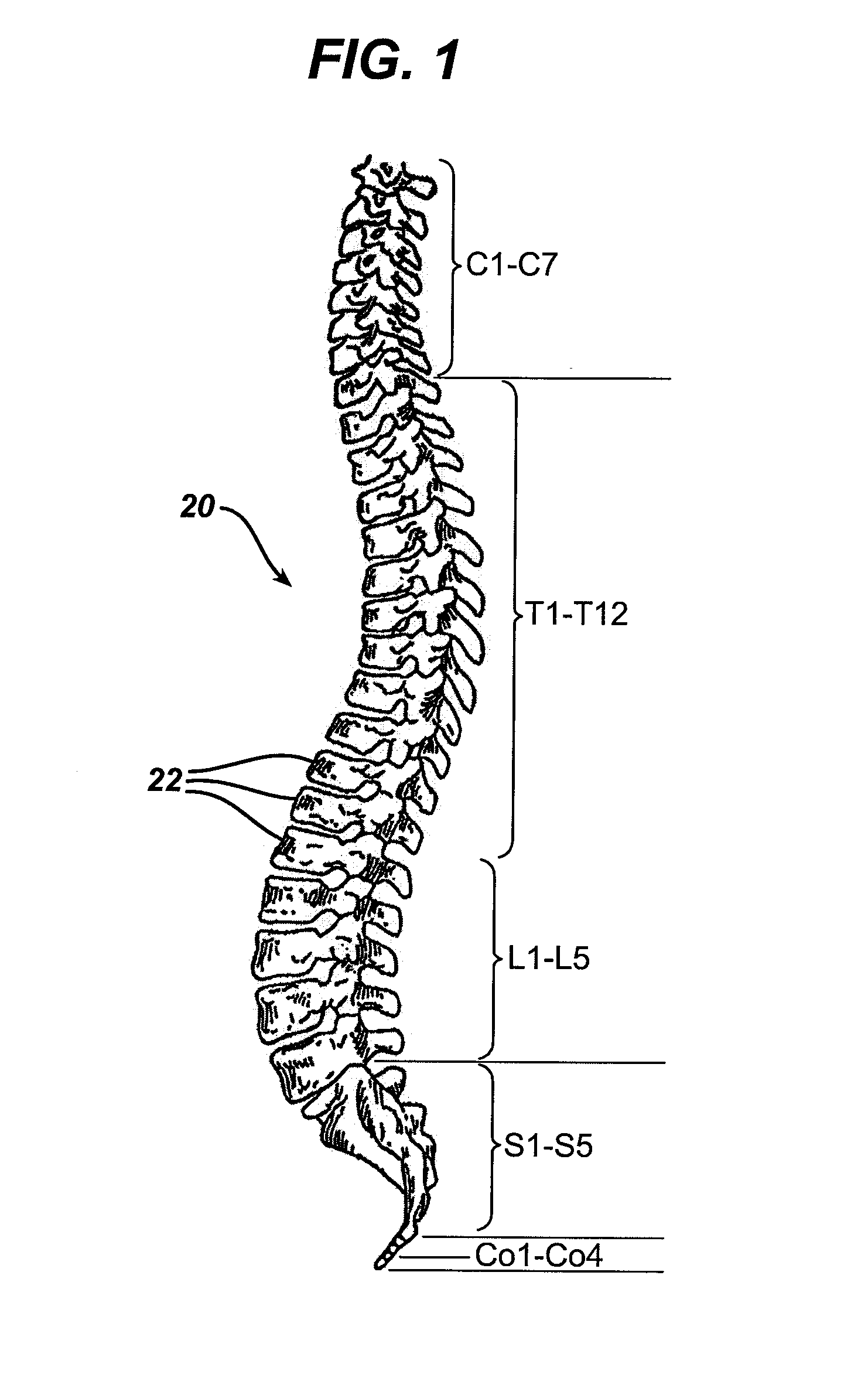 Intra-facet fixation device and method of use
