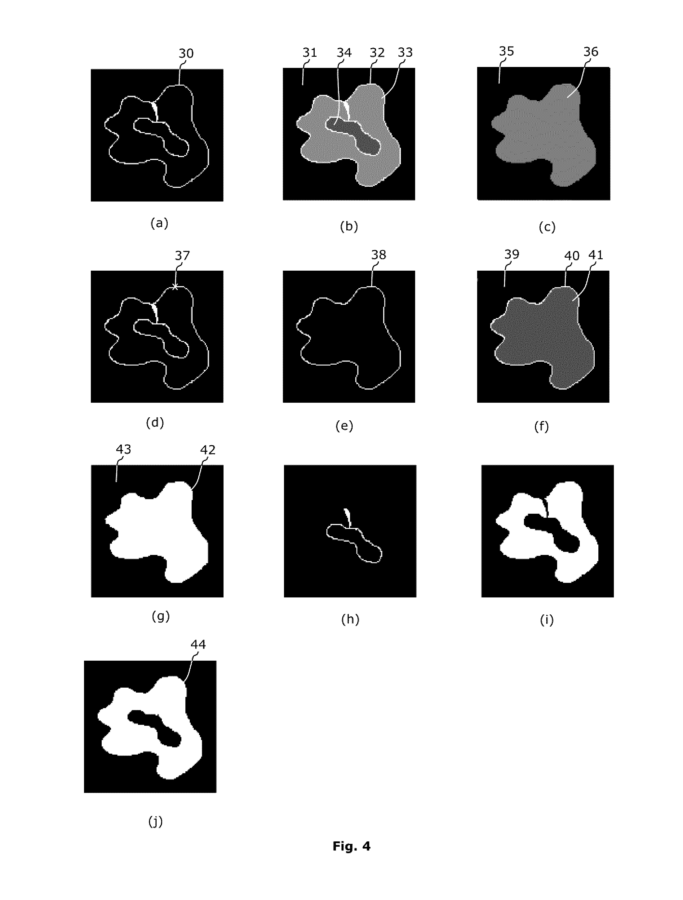 Topology-preserving roi remapping method between medical images