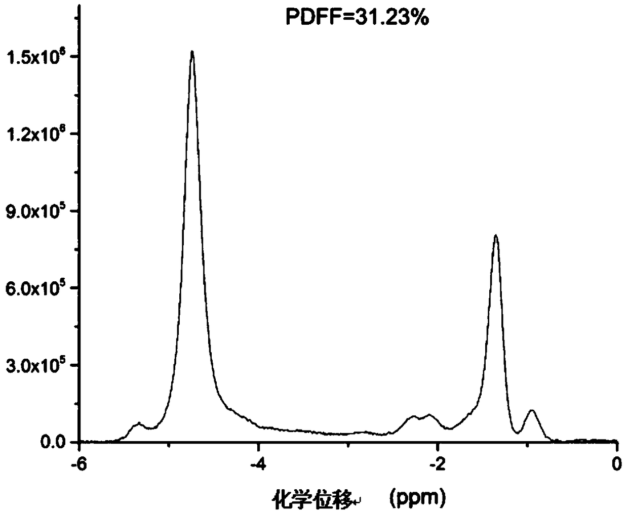 Magnetic resonance spectrum full-automatic post-processing method for quantifying fat content