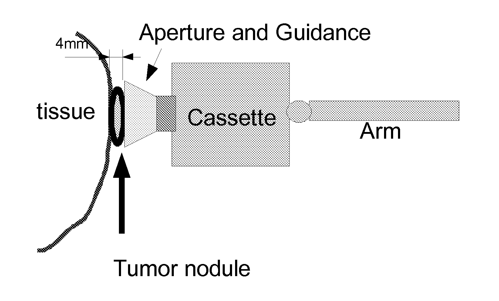 Direct Visualization Robotic Intra-Operative Radiation Therapy Applicator Device