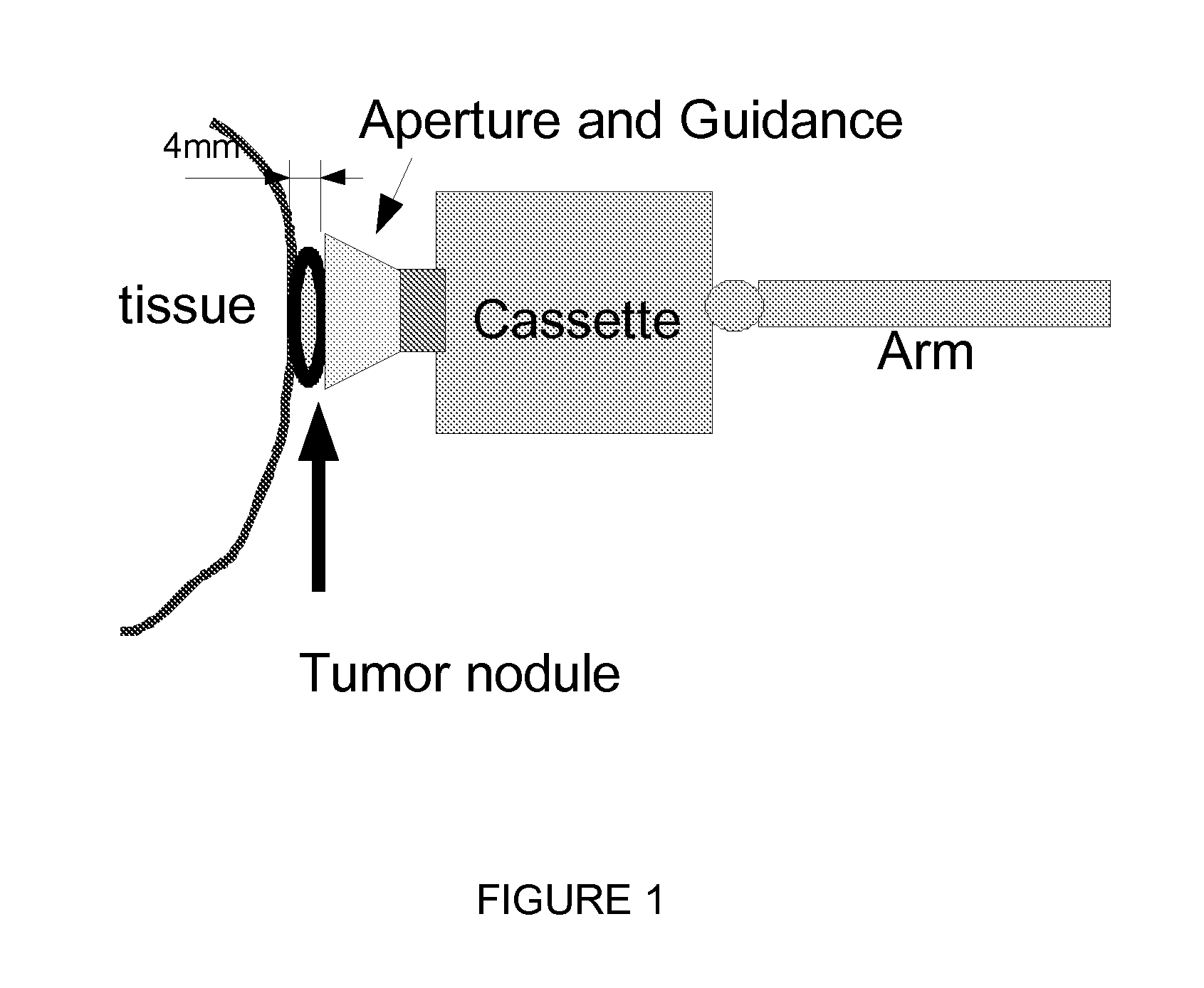 Direct Visualization Robotic Intra-Operative Radiation Therapy Applicator Device